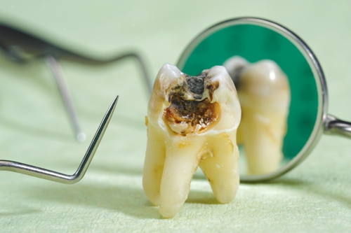 Top Dental Health Problems You Might Have